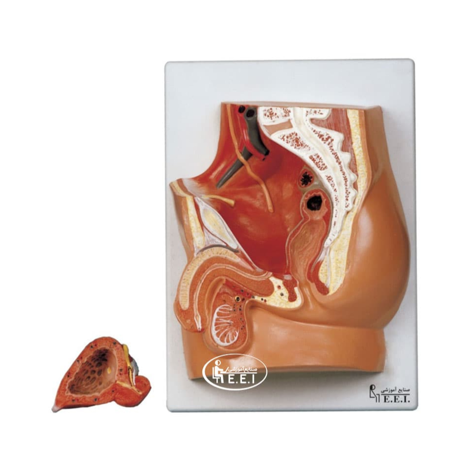 مدل لگن خاصره مرد - این مدل در اندازه طبیعی است و به دو قطعه تفکیک می‌شود. در این مدل ساختمان مثانه و اندام‌های تناسلی مرد در مقطع میانی و موقعیت آن‌ها در حفره لگن نمایش داده شده است. مدل روی تخته نصب شده است.در این مدل نحوه استقرار مثانه در حفره لگن، ارتباط میزنای با مثانه و عبور کانال دفران(اسپرم بر) از کشاله‌ران مشا ...