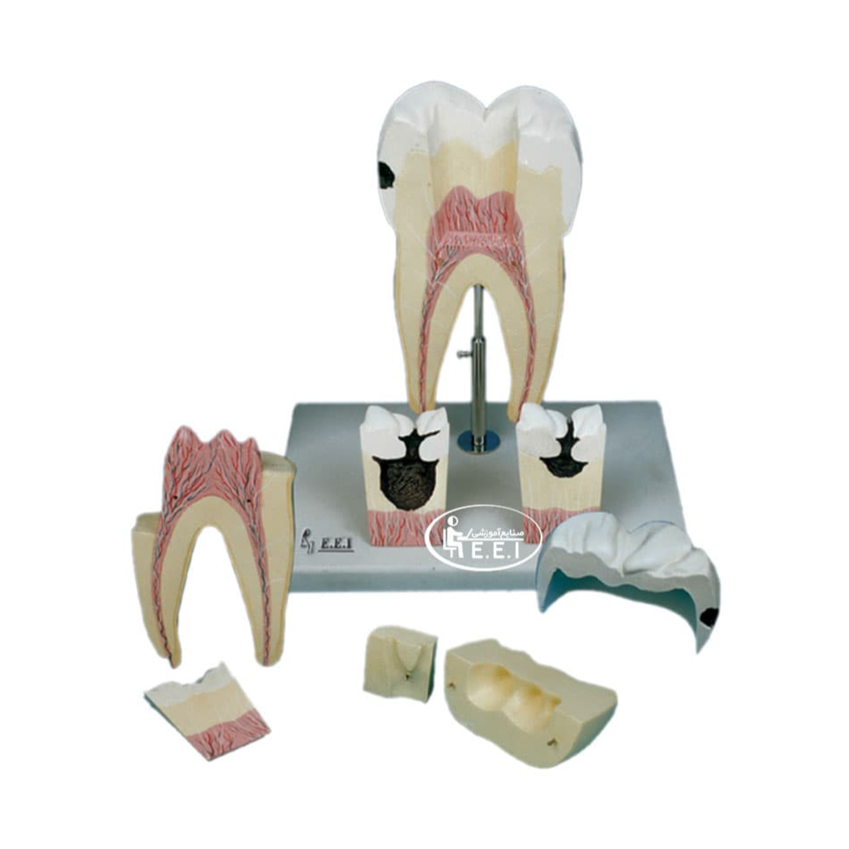 مدل اولین دندان آسیاب فک تحتانی - این مدل تقریبا 16 برابر اندازه طبیعی در 8 قطعه با برش طولی در ناحیه تاج و ریشه می‌گذرد به دو قطعه تقسیم می‌شود. در ناحیه تاج، نیمی از مینا و عاج و در ناحیه ریشه بخشی از عاج تفکیک می‌شود. بزرگی مدل، آموزش ساختمان دندان را به خوبی میسر می‌سازد. در این مدل همچنین ریشه‌ها، کانال‌های مربوطه و قطعه‌‌هایی  ...